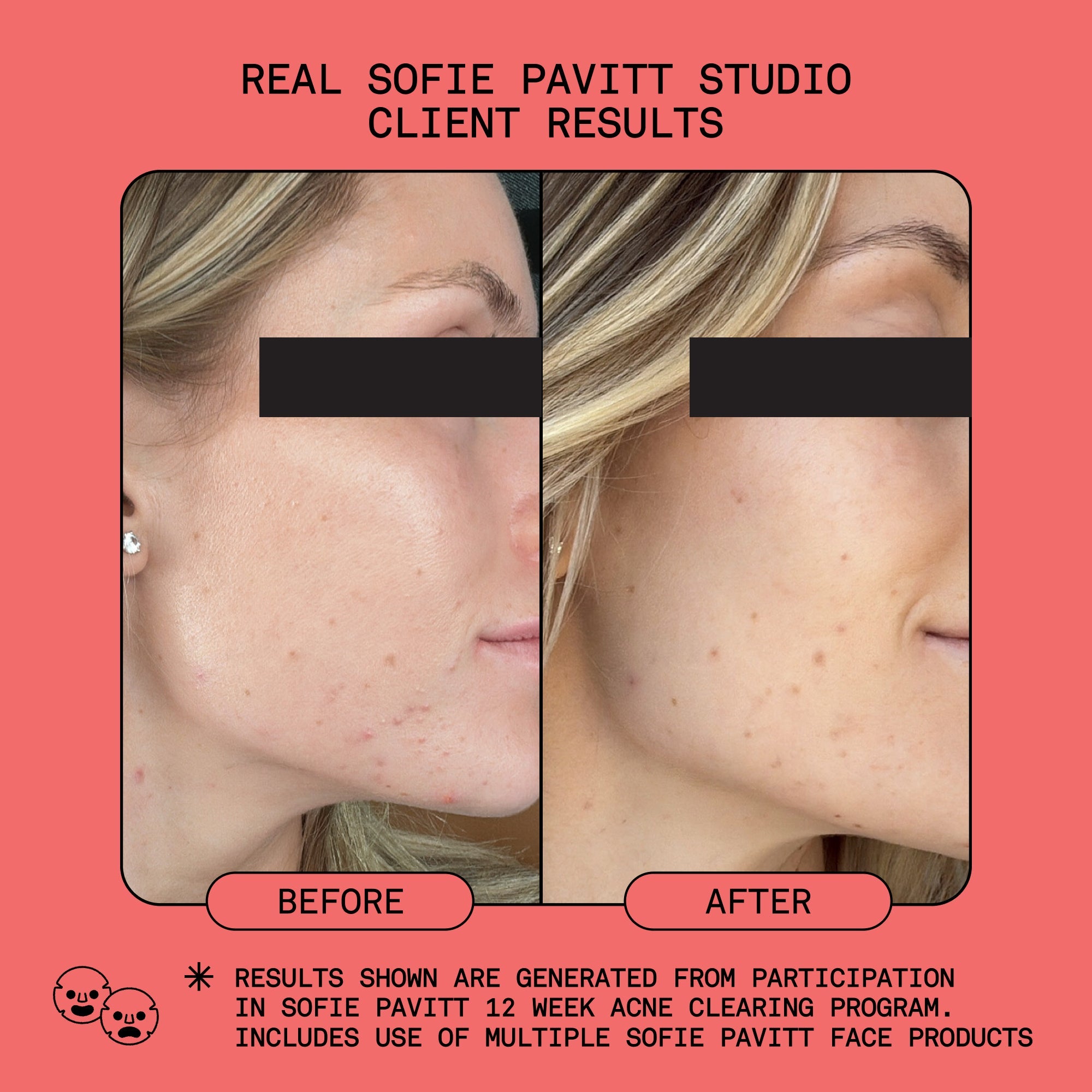 sofie pavitt studio-smooth microdermabrasion treatment scrub